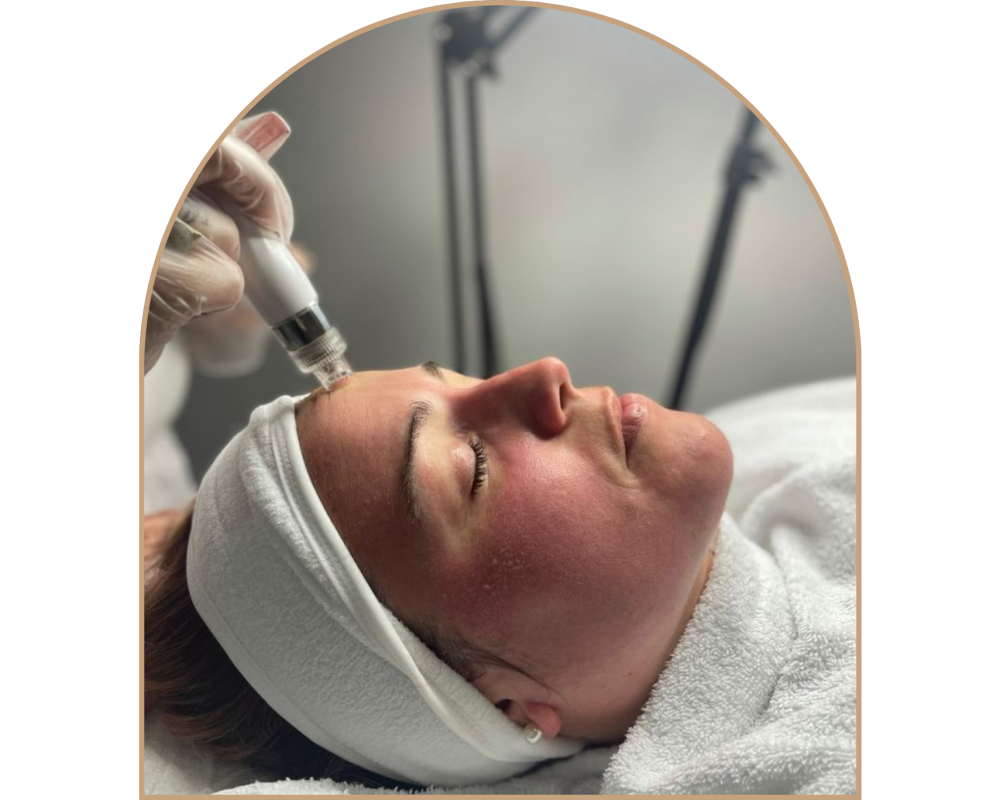 9 Radiofrequence visage 9 Radiofrequence visage